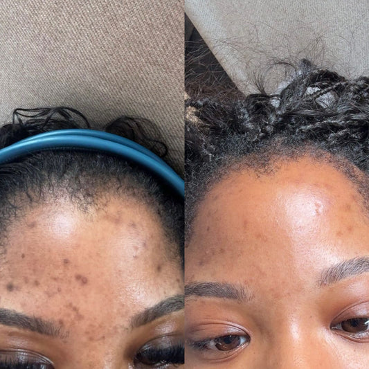 MELACLEAR CREAM pré commande