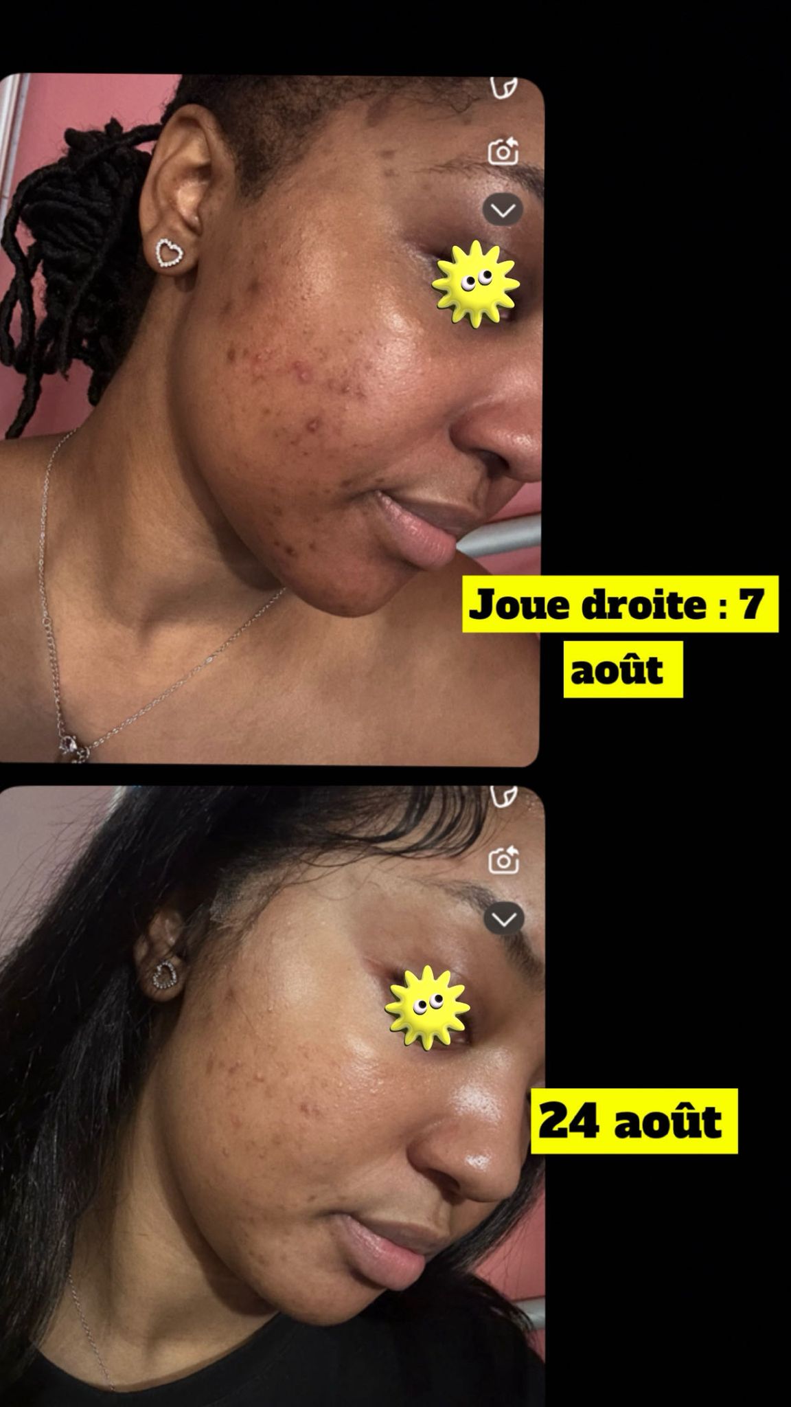 MELACLEAR CREAM