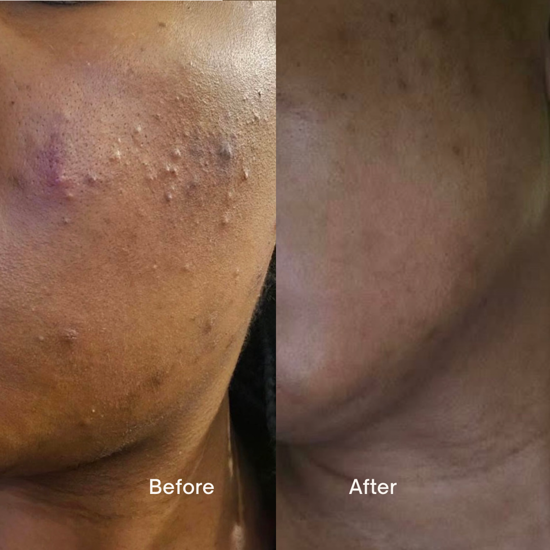 DERMA CLEAR WASH