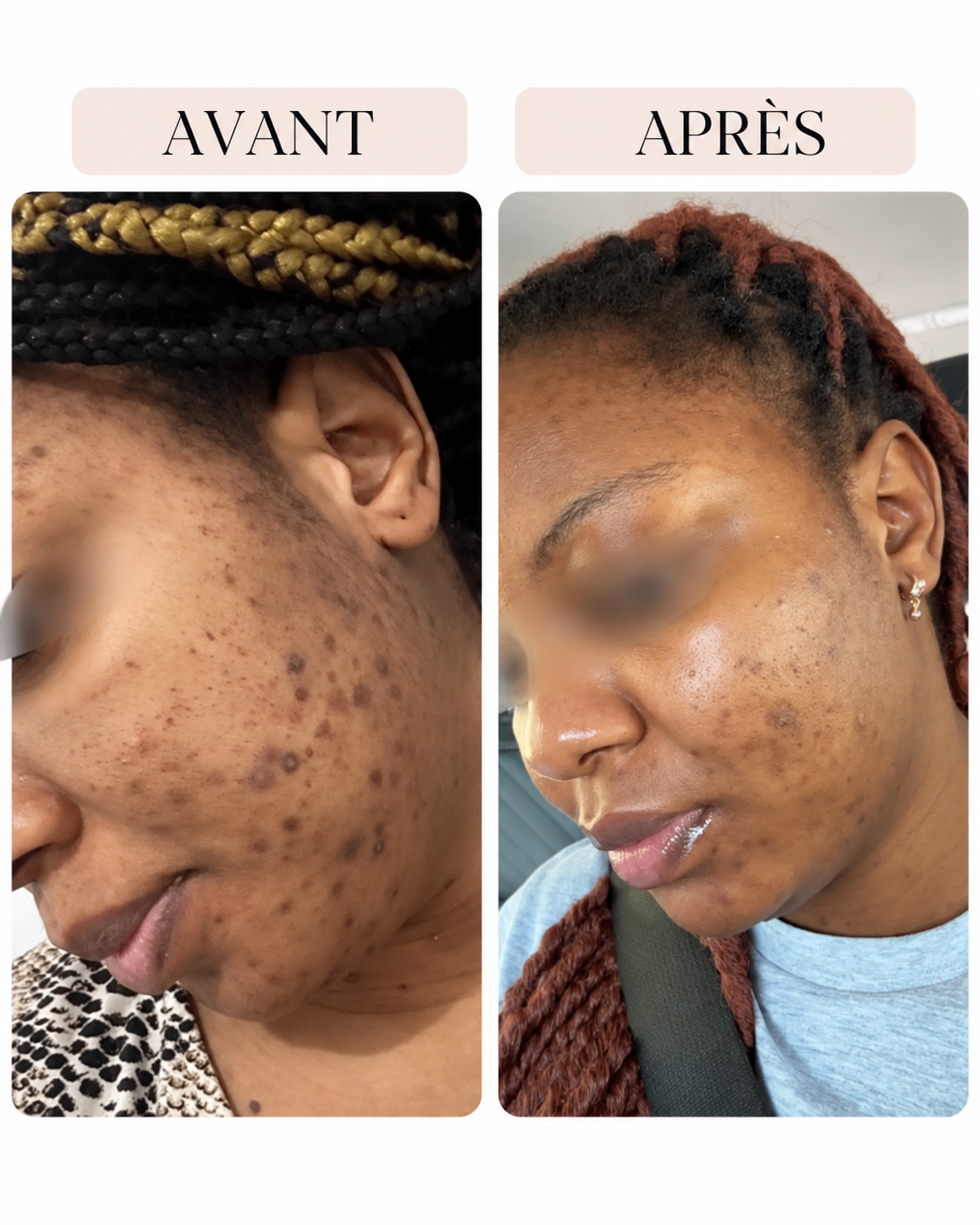 DERMA NOVA WASH