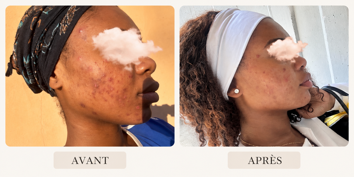 MELACLEAR CREAM